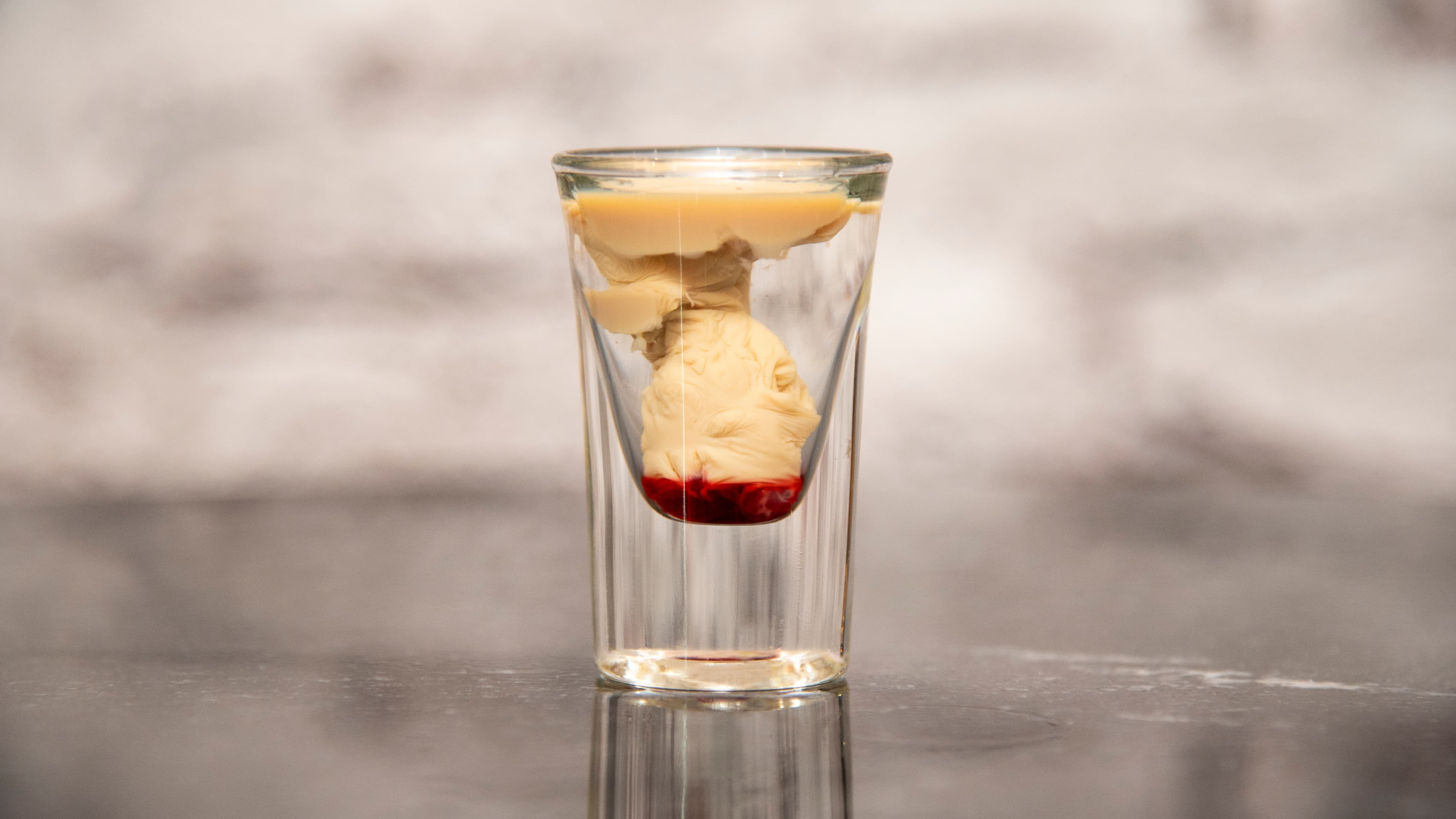 МОЗЪЧЕН ТУМOР